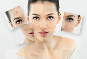 Гормональный сбой: 15 вопросов, помогающие определить, есть ли он у вас