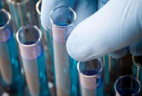 Емкость поглощения радикалов кислорода - высококлассные ORAC продукты, способные замедлить старение