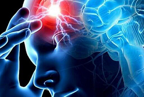 3 первых признака инсульта: запомните, чтобы спасти жизнь!