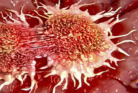 Почему это скрывают от общественности: 10 основных причин рака, которые мы используем каждый день!