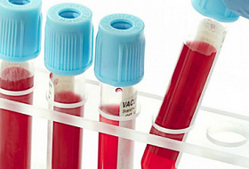 9 показателей крови, которые расскажут все о вашем здоровье