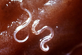 Черви-убийцы. Как паразиты пожирают вас изнутри