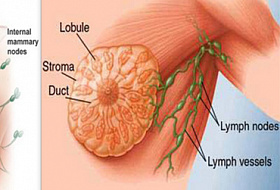 Причины рака молочной железы!