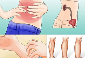 5  признаков того, что возможно, у вас заболевания почек!