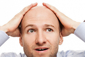 Какие причины вызывают облысение у человека